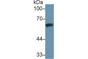 Western Blot; Sample: Human Lung lysate; Primary Ab: 3µg/ml Mouse Anti-Human DBP Antibody Second Ab: 0. (Vitamin D-Binding Protein Antikörper  (AA 209-401))
