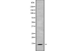 Western blot analysis SH3BGRL2 using HepG2 whole cell lysates (SH3BGRL2 Antikörper  (Internal Region))