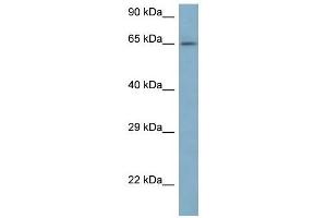 Western Blot showing ARFGAP3 antibody used at a concentration of 1 ug/ml against 721_B Cell Lysate (ARFGAP3 Antikörper  (N-Term))