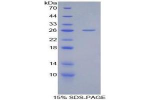 SDS-PAGE analysis of Chicken Adiponectin Protein. (ADIPOQ Protein)
