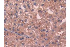 DAB staining on IHC-P; Samples: Human Liver Tissue (SIGIRR Antikörper  (AA 1-118))