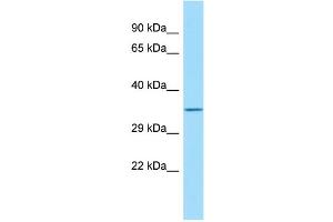 Host: Rabbit Target Name: FAM49B Sample Type: HT1080 Whole Cell lysates Antibody Dilution: 1. (FAM49B Antikörper  (C-Term))