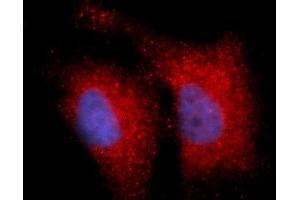 Immunofluorescence (IF) image for anti-Integrin beta 1 (ITGB1) (AA 21-461) antibody (APC) (ABIN5566381) (ITGB1 Antikörper  (AA 21-461) (APC))