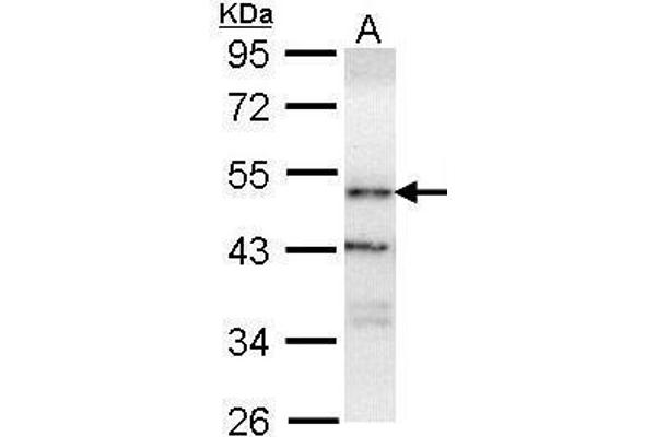 OSBPL1A Antikörper  (C-Term)