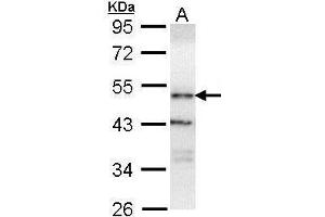WB Image Sample (30 ug of whole cell lysate) A: H1299 10% SDS PAGE antibody diluted at 1:1000 (OSBPL1A Antikörper  (C-Term))