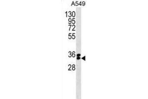 Western Blotting (WB) image for anti-F-Box Protein 44 (FBXO44) antibody (ABIN5019782) (FBXO44 Antikörper)