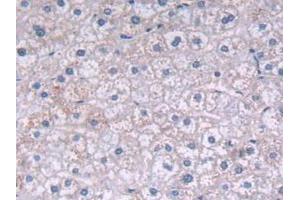 IHC-P analysis of Human Liver Tissue, with DAB staining. (FADS2 Antikörper  (AA 1-130))