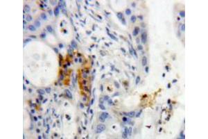 IHC-P analysis of pancreas tissue, with DAB staining. (REG3g Antikörper  (AA 39-175))