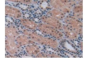 Immunohistochemistry (IHC) image for anti-Pro-Platelet Basic Protein (Chemokine (C-X-C Motif) Ligand 7) (PPBP) (AA 59-128) antibody (ABIN7431659)