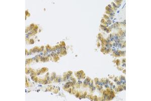 Immunohistochemistry of paraffin-embedded mouse lung using NMU antibody (ABIN6290689) at dilution of 1:100 (40x lens). (Neuromedin U Antikörper)