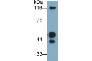 Detection of KNG1 in Human Plasma using Polyclonal Antibody to Kininogen 1 (KNG1) (KNG1 Antikörper  (AA 390-644))