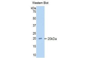 Western Blotting (WB) image for anti-Alpha2 Antiplasmin (SERPINF2) (AA 348-491) antibody (ABIN1857850) (alpha 2 Antiplasmin Antikörper  (AA 348-491))