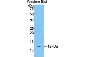 Detection of Recombinant DBI, Mouse using Polyclonal Antibody to Diazepam Binding Inhibitor (DBI) (Diazepam Binding Inhibitor Antikörper  (AA 2-87))