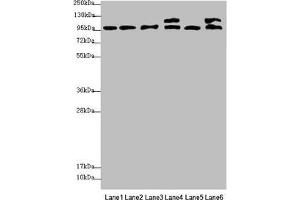 Western blot All lanes: NAA25 antibody at 2. (NAA25 Antikörper  (AA 703-972))