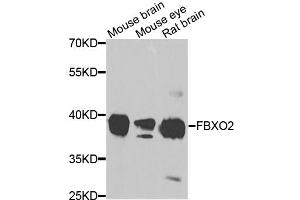 Western blot analysis of extracts of various cell lines, using FBXO2 antibody. (FBXO2 Antikörper)