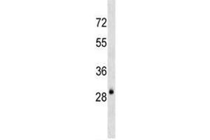 AQP3 antibody western blot analysis in mouse kidney tissue lysate (AQP3 Antikörper  (AA 163-191))