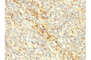 Immunohistochemistry (IHC) image for anti-Transglutaminase 2 (C Polypeptide, Protein-Glutamine-gamma-Glutamyltransferase) (TGM2) antibody (ABIN6940725)