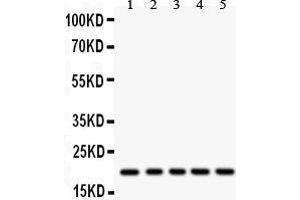 Anti- RAC1 Picoband antibody, Western blotting All lanes: Anti RAC1  at 0. (RAC1 Antikörper  (C-Term))