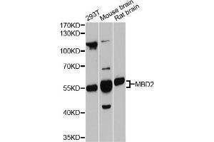 Western blot analysis of extracts of various cell lines, using MBD2 antibody (ABIN5998188) at 1:3000 dilution. (MBD2 Antikörper)
