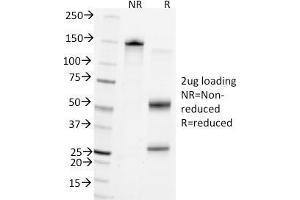 SDS-PAGE Analysis Purified CD45 Mouse Monoclonal Antibody (Bra55). (CD45 Antikörper)