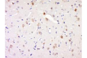 Paraformaldehyde-fixed, paraffin embedded rat brain, Antigen retrieval by boiling in sodium citrate buffer (pH6) for 15min, Block endogenous peroxidase by 3% hydrogen peroxide for 30 minutes, Blocking buffer (normal goat serum) at 37°C for 20min, Antibody incubation with Synaptojanin 1 Antibody, Unconjugated  at 1:200 overnight at 4°C, followed by a conjugated secondary and DAB staining. (Synaptojanin 1 Antikörper  (AA 481-580))