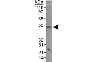 Western blot analysis of PLIN3 in 3T3-L1 lysate using PLIN3 polyclonal antibody . (PLIN3 Antikörper  (AA 350-435))