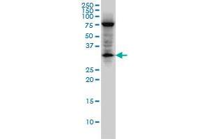 EDA2R monoclonal antibody (M02), clone 3C1. (Ectodysplasin A2 Receptor Antikörper  (AA 1-110))