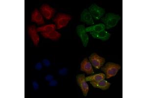ABIN6265691 and ABIN6276606 staining Hela cells by IF/ICC. (TPM3 Antikörper  (N-Term))