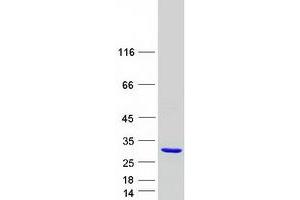Western Blotting (WB) image for Deleted in Primary Ciliary Dyskinesia Homolog (DPCD) protein (Myc-DYKDDDDK Tag) (ABIN2719692)