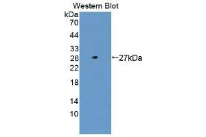 Western blot analysis of the recombinant protein. (NASP Antikörper  (AA 3-223))