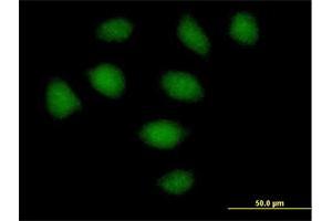 Immunofluorescence of purified MaxPab antibody to SECISBP2 on HeLa cell. (SECISBP2 Antikörper  (AA 1-854))