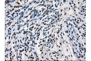 Immunohistochemical staining of paraffin-embedded Ovary tissue using anti-LEMD3mouse monoclonal antibody. (LEMD3 Antikörper)
