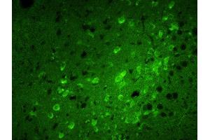 Formalin-fixed and paraffin embedded rat brain labeled with Rabbit Anti-Calreticulin Polyclonal Antibody, FITC Conjugated  at 1:100 for 40 minutes at 37°C. (Calreticulin Antikörper  (AA 101-200) (FITC))