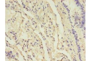 Immunohistochemistry of paraffin-embedded human lung tissue using ABIN7157832 at dilution of 1:100 (B3GNT5 Antikörper  (AA 65-344))