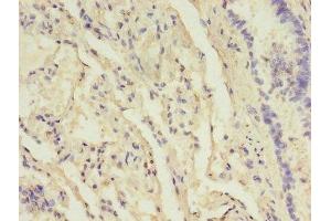 Immunohistochemistry (IHC) image for anti-UDP-GlcNAc:betaGal beta-1,3-N-Acetylglucosaminyltransferase 5 (B3GNT5) (AA 65-344) antibody (ABIN7157832)