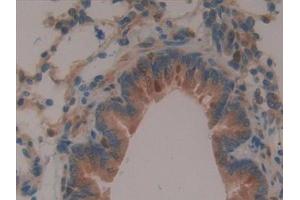 Immunohistochemistry (IHC) image for anti-Ring Finger Protein 112 (RNF112) (AA 256-504) antibody (ABIN7442381)