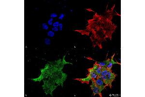 Immunocytochemistry/Immunofluorescence analysis using Mouse Anti-NALCN Monoclonal Antibody, Clone S187-7 . (NALCN Antikörper  (AA 1659-1738) (FITC))