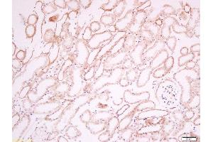 Paraformaldehyde-fixed, paraffin embedded mouse kidney tissue, Antigen retrieval by boiling in sodium citrate buffer(pH6) for 15min, Block endogenous peroxidase by 3% hydrogen peroxide for 30 minutes, Blocking buffer (normal goat serum) at 37°C for 20min, Antibody incubation with Rabbit Anti-CD34 Polyclonal Antibody, Unconjugated  at 1:200 overnight at 4°C, followed by a conjugated secondary and DAB staining (CD34 Antikörper  (AA 210-260))