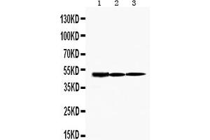 Western Blotting (WB) image for anti-Hepatitis A Virus Cellular Receptor 1 (HAVCR1) (AA 289-307), (C-Term) antibody (ABIN3044229)