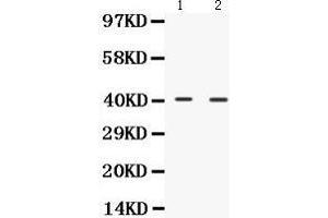Western Blotting (WB) image for anti-NDRG Family Member 2 (NDRG2) (AA 210-247), (C-Term) antibody (ABIN3043261)
