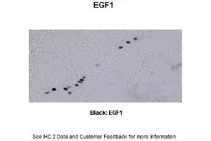 Sample Type :  Frog brain  Primary Antibody Dilution :  1:500  Secondary Antibody :  Biotinylated goat anti-rabbit  Secondary Antibody Dilution :  1:200  Color/Signal Descriptions :  Black: EGF1  Gene Name :  EGR1 a  Submitted by :  Eva Fischer, Colorado State University (EGR1 Antikörper  (N-Term))