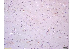 Formalin-fixed and paraffin embedded human brain with labeled Anti-TIE1 Polyclonal Antibody, Unconjugated (ABIN675099) at 1:200, followed by conjugation to the secondary antibody and DAB staining (TIE1 Antikörper  (AA 851-1000))