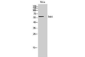 Western Blotting (WB) image for anti-Disabled Homolog 1 (Drosophila) (DAB1) (Ser295) antibody (ABIN3174701) (DAB1 Antikörper  (Ser295))