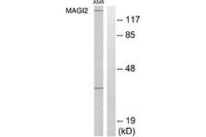 Western blot analysis of extracts from A549 cells, using MAGI2 Antibody. (MAGI2 Antikörper  (AA 221-270))