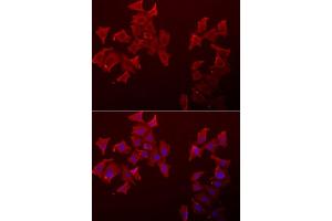 Immunofluorescence analysis of A549 cell using LECT1 antibody. (LECT1 Antikörper)