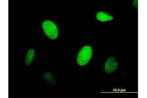 Immunofluorescence of purified MaxPab antibody to CENPJ on HeLa cell. (CENPJ Antikörper  (AA 1-372))