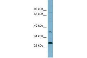 Image no. 1 for anti-Nitric Oxide Synthase Interacting Protein (NOSIP) (AA 35-84) antibody (ABIN6742140) (NOSIP Antikörper  (AA 35-84))