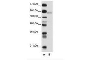 Image no. 1 for anti-Zinc Finger and BTB Domain Containing 22 (ZBTB22) (AA 421-470) antibody (ABIN6736152)
