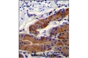 DFNB31 Antibody (Center) (ABIN655065 and ABIN2844695) immunohistochemistry analysis in formalin fixed and paraffin embedded stomach tissue followed by peroxidase conjugation of the secondary antibody and DAB staining. (DFNB31 Antikörper  (AA 378-406))