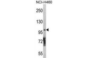 Western Blotting (WB) image for anti-Diacylglycerol Kinase, theta 110kDa (DGKQ) antibody (ABIN3003694) (DGKQ Antikörper)